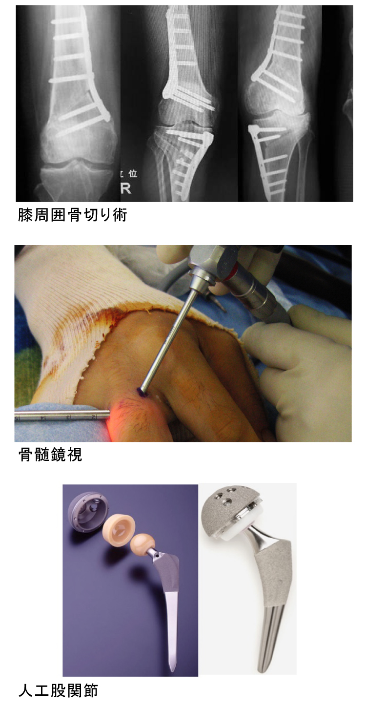 整形外科 兵庫医科大学病院