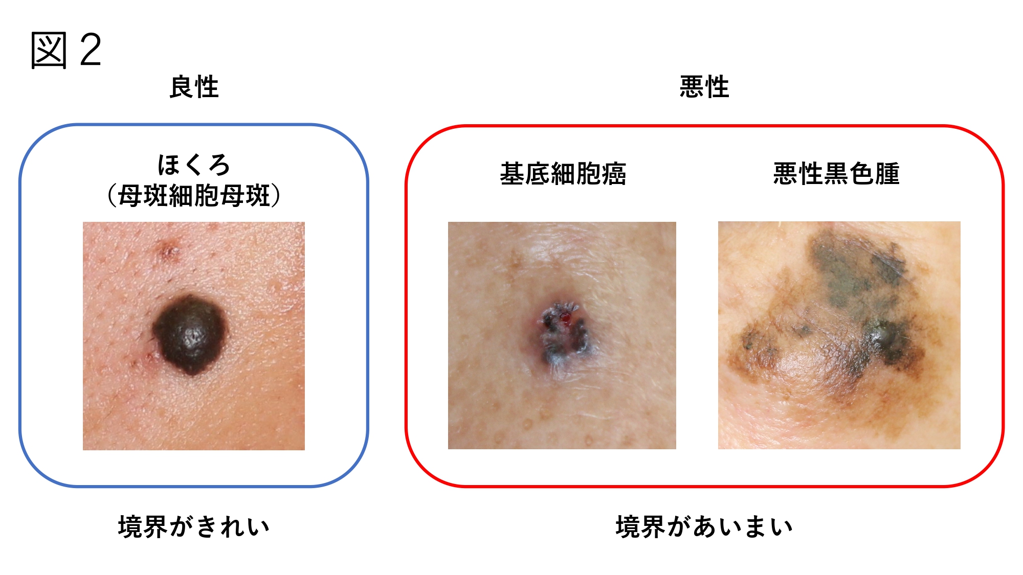 ほくろ みんなの医療ガイド 兵庫医科大学病院