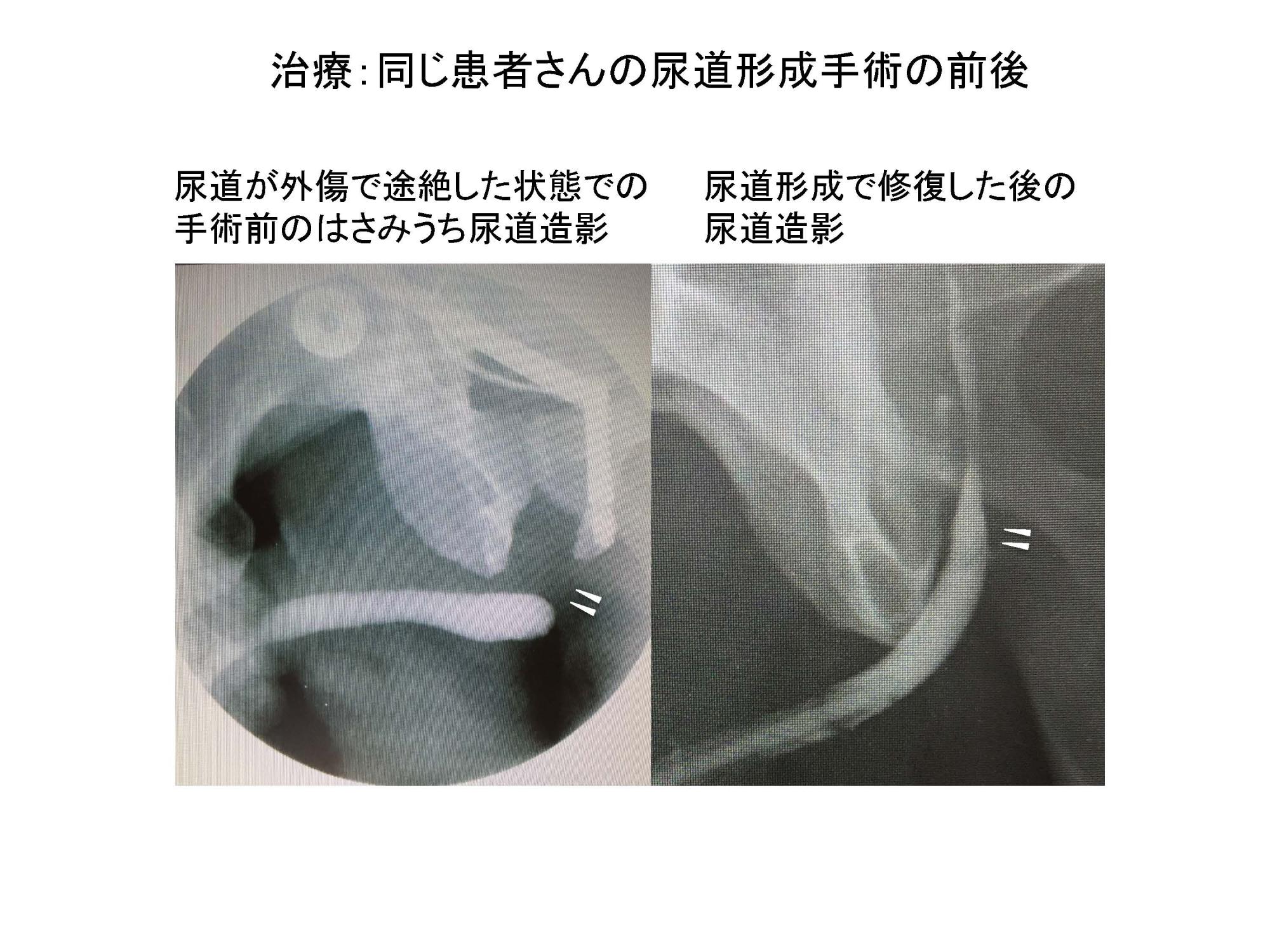 若い男性の勃起不全が原因です